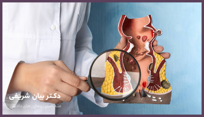 خطرات و عوارض جراحی هموروئید 